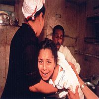 fgm
